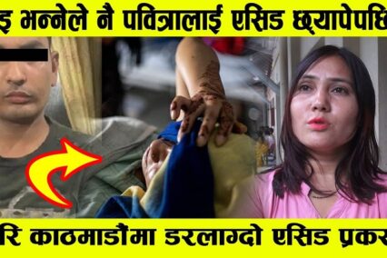 फेरि काठमाडौंमा डरलाग्दो एसिड प्रकरण, दिदिले खुलाइन सहस्य